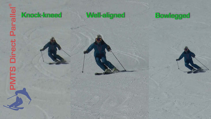 Alignment ~ On-snow Assessment eVideo